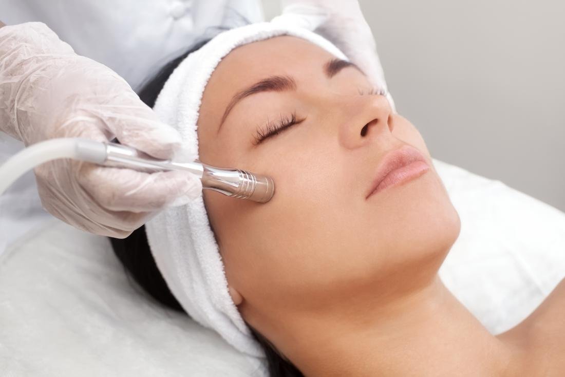 microdermabrasion